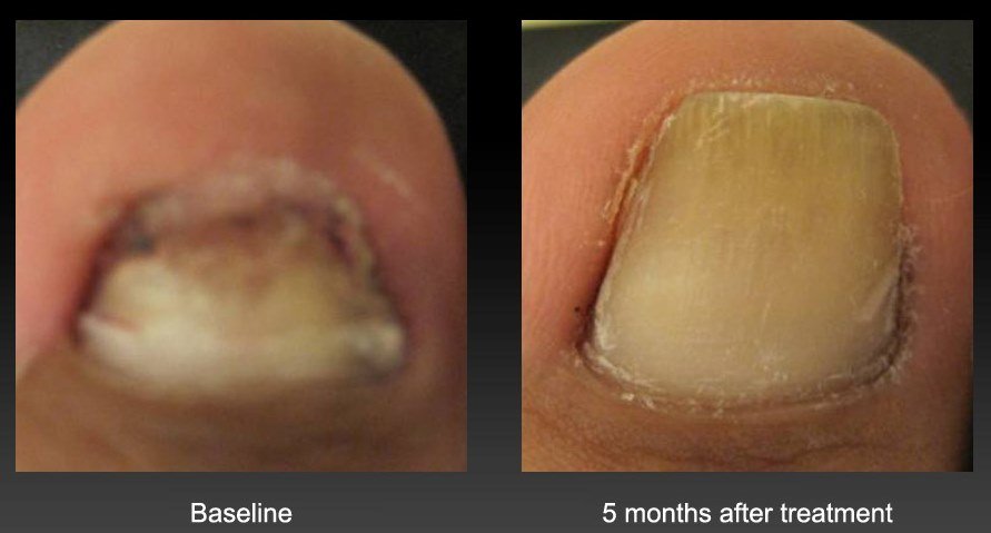 before-after-nail-3.jpg